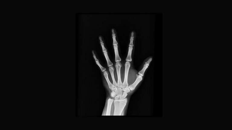 Aplicativo móvel de raios-X: verdade ou mito?